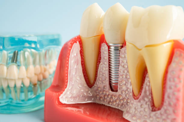 Professional  Dental Services in Montpelier, VT